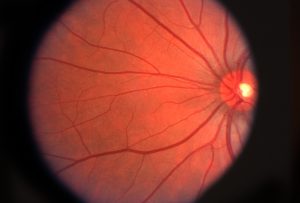 retina ojo optica en sevilla